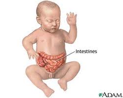 intestines