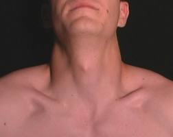 neck